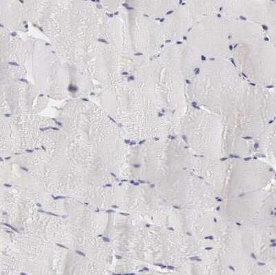Immunohistochemistry-Paraffin: Ribonuclease A Antibody [NBP1-87804]