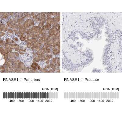 Immunohistochemistry-Paraffin: Ribonuclease A Antibody [NBP1-87804]