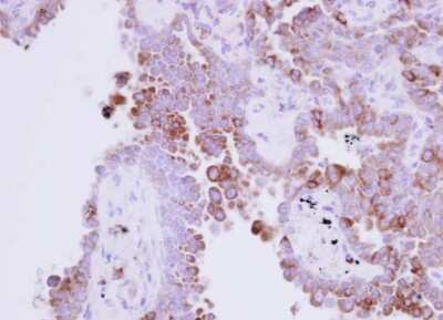 Immunohistochemistry-Paraffin: Ribonuclease A Antibody [NBP2-20160]