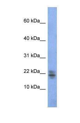 Western Blot: Ribonuclease A Antibody [NBP1-69256]