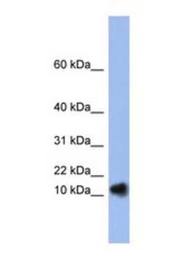 Western Blot: Ribonuclease A Antibody [NBP1-69257]