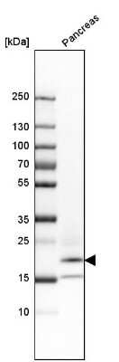 Western Blot: Ribonuclease A Antibody [NBP1-87804]