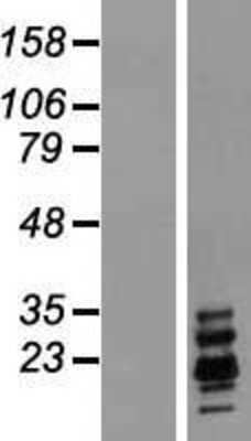 Western Blot: Ribonuclease A Overexpression Lysate [NBL1-15392]