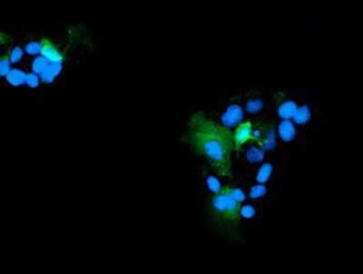 Immunocytochemistry/ Immunofluorescence: Ribonuclease Inhibitor Antibody (OTI1B7) [NBP2-03254]