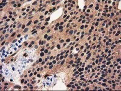 Immunohistochemistry-Paraffin: Ribonuclease Inhibitor Antibody (OTI1B7) [NBP2-03254]