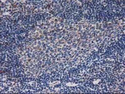 Immunohistochemistry-Paraffin: Ribonuclease Inhibitor Antibody (OTI1B7) [NBP2-03254]