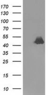 Western Blot: Ribonuclease Inhibitor Antibody (OTI1B7) [NBP2-03254]