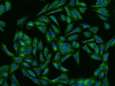 Immunocytochemistry/ Immunofluorescence: Ribonuclease Inhibitor Antibody [NBP2-99628]