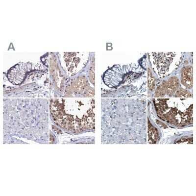 Immunohistochemistry-Paraffin: Ribonuclease Inhibitor Antibody [NBP1-87161]