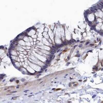 Immunohistochemistry-Paraffin: Ribonuclease Inhibitor Antibody [NBP1-87161]
