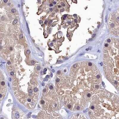Immunohistochemistry-Paraffin: Ribonuclease Inhibitor Antibody [NBP1-87161]