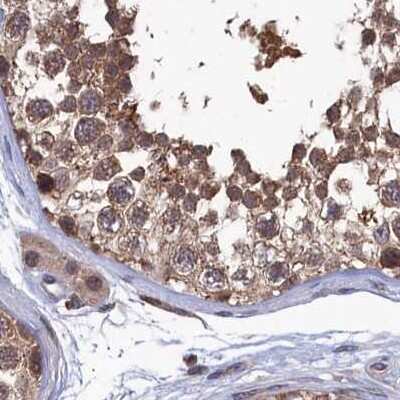 Immunohistochemistry-Paraffin: Ribonuclease Inhibitor Antibody [NBP1-87161]