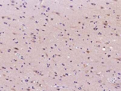 Immunohistochemistry-Paraffin: Ribonuclease Inhibitor Antibody [NBP2-99628]