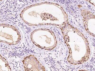Immunohistochemistry-Paraffin: Ribonuclease Inhibitor Antibody [NBP2-99628]