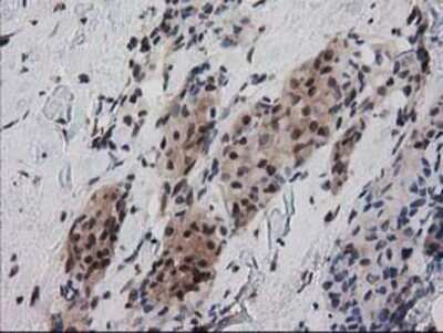 Immunohistochemistry: Ribonuclease Inhibitor Antibody (OTI1B7) - Azide and BSA Free [NBP2-73896]