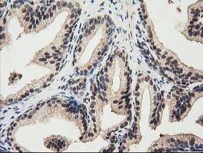 Immunohistochemistry: Ribonuclease Inhibitor Antibody (OTI1B7) - Azide and BSA Free [NBP2-73896]
