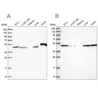 Western Blot: Ribonuclease Inhibitor Antibody [NBP1-87161]