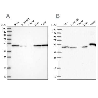 Western Blot: Ribonuclease Inhibitor Antibody [NBP1-87162]