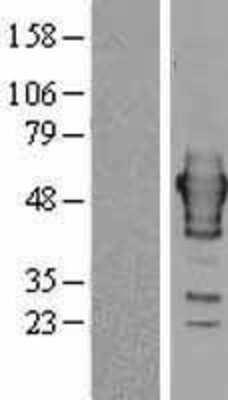 Western Blot: Ribonuclease Inhibitor Overexpression Lysate [NBL1-15462]