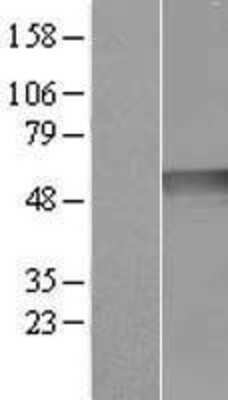 Western Blot: Ribonuclease Inhibitor Overexpression Lysate [NBL1-15463]