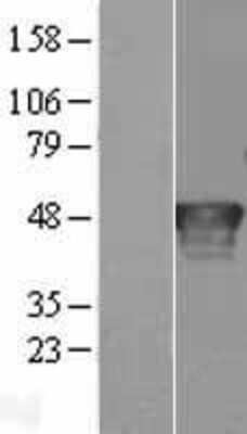 Western Blot: Ribonuclease Inhibitor Overexpression Lysate [NBL1-15464]