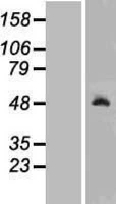 Western Blot: Ribonuclease Inhibitor Overexpression Lysate [NBL1-15466]