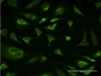 Immunocytochemistry/ Immunofluorescence: Ribophorin I Antibody (4B1-1E6) [H00006184-M03]