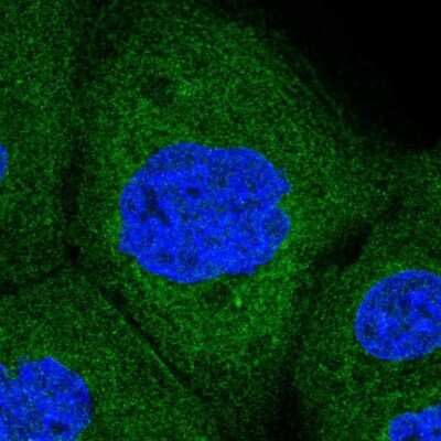 Immunocytochemistry/ Immunofluorescence: Ribophorin I Antibody [NBP2-55523]