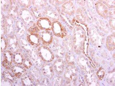 Immunohistochemistry-Paraffin: Ribophorin I Antibody [NBP1-32704]