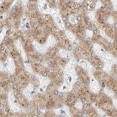 Immunohistochemistry-Paraffin: Ribophorin I Antibody [NBP1-82467]