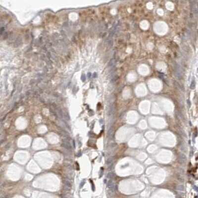 Immunohistochemistry-Paraffin: Ribophorin I Antibody [NBP1-82467]