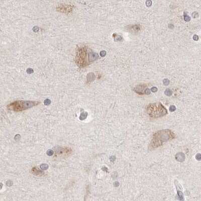 Immunohistochemistry-Paraffin: Ribophorin I Antibody [NBP1-82467]