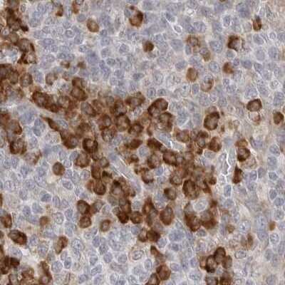 Immunohistochemistry-Paraffin: Ribophorin I Antibody [NBP1-82467]