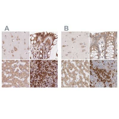 Immunohistochemistry-Paraffin: Ribophorin I Antibody [NBP2-55523]