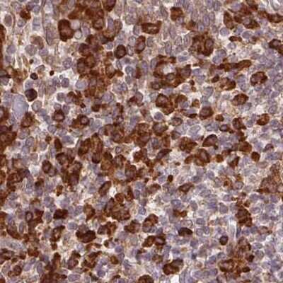 Immunohistochemistry-Paraffin: Ribophorin I Antibody [NBP2-55523]