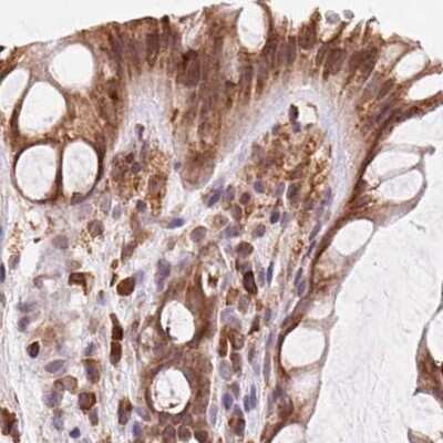 Immunohistochemistry-Paraffin: Ribophorin I Antibody [NBP2-55523]