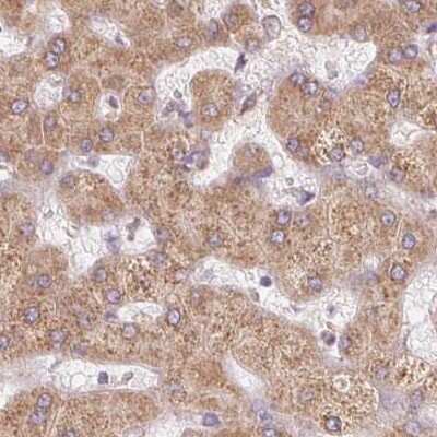 Immunohistochemistry-Paraffin: Ribophorin I Antibody [NBP2-55523]