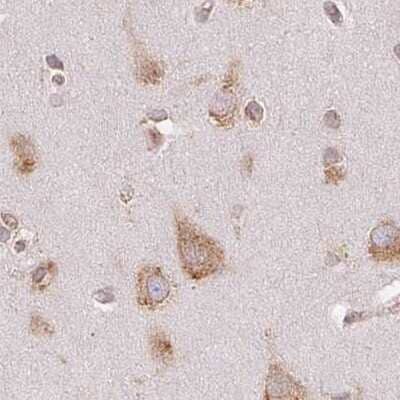 Immunohistochemistry-Paraffin: Ribophorin I Antibody [NBP2-55523]