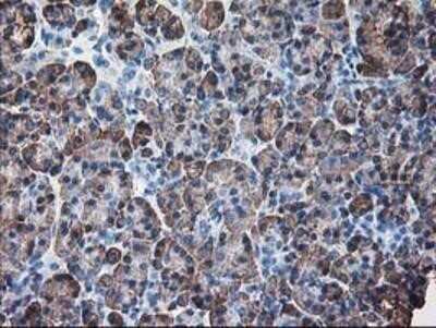 Immunohistochemistry: Ribophorin I Antibody (OTI3H3) - Azide and BSA Free [NBP2-73898]