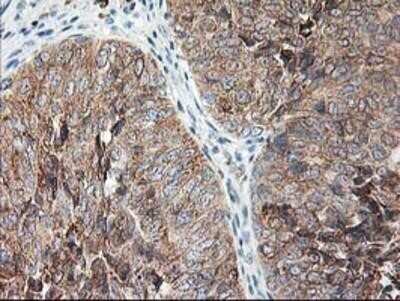 Immunohistochemistry: Ribophorin I Antibody (OTI3H3) - Azide and BSA Free [NBP2-73898]