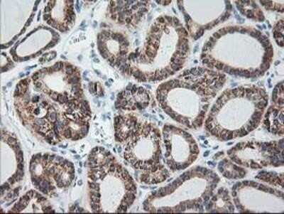 Immunohistochemistry: Ribophorin I Antibody (OTI3H3) - Azide and BSA Free [NBP2-73898]