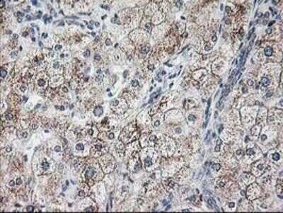 Immunohistochemistry: Ribophorin I Antibody (OTI3H3) - Azide and BSA Free [NBP2-73898]