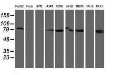Western Blot: Ribophorin I Antibody (OTI3H3)Azide and BSA Free [NBP2-73898]