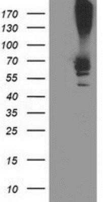 Western Blot: Ribophorin I Antibody (OTI3H3)Azide and BSA Free [NBP2-73898]