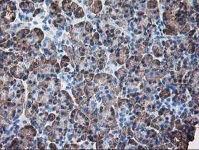 Immunohistochemistry: Ribophorin I Antibody (OTI3H3) [NBP2-01294]
