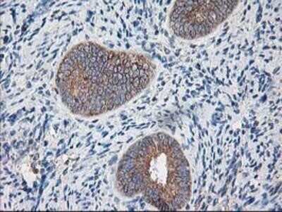 Immunohistochemistry-Paraffin: Ribophorin I Antibody (OTI3H3) [NBP2-01294]