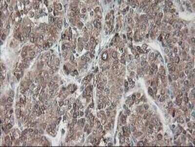 Immunohistochemistry-Paraffin: Ribophorin I Antibody (OTI3H3) [NBP2-01294]