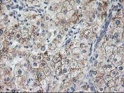 Immunohistochemistry-Paraffin: Ribophorin I Antibody (OTI3H3) [NBP2-01294]