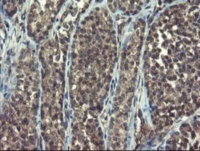 Immunohistochemistry: Ribophorin I Antibody (OTI5B1) - Azide and BSA Free [NBP2-73905]
