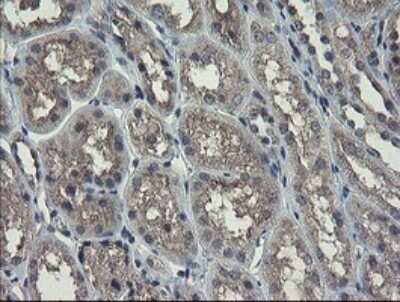 Immunohistochemistry: Ribophorin I Antibody (OTI5B1) - Azide and BSA Free [NBP2-73905]